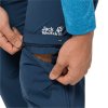 Abzipbar am Knie / Zip away at knee length